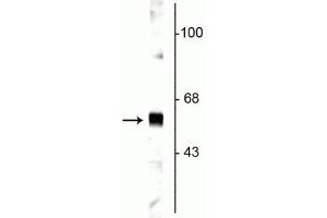 Western blot of rat cortical lysate showing specific labeling of the ~65 kDa synaptotagmin protein. (SYT1 抗体)