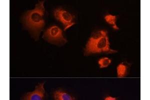 Immunofluorescence analysis of A431 cells using MCL1 Polyclonal Antibody at dilution of 1:100 (40x lens). (MCL-1 抗体)