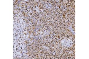 IHC analysis of SP1 using anti-SP1 antibody (ABIN7601559). (SP1 抗体  (AA 384-603))