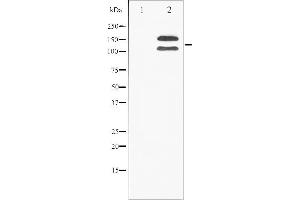 Western blot analysis of FGFR1 phosphorylation expression in 293 whole cell lysates,The lane on the left is treated with the antigen-specific peptide. (FGFR1 抗体  (pTyr154))