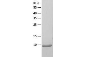 Western Blotting (WB) image for Chemokine (C-X-C Motif) Ligand 5 (CXCL5) (AA 41-114) protein (His tag) (ABIN7122340)