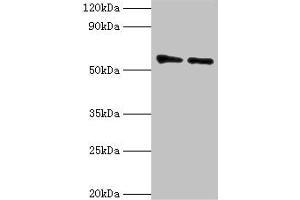 Western blot All lanes: OXCT1 antibody at 8 μg/mL Lane 1: Mouse heart tissue Lane 2: Mouse kidney tissue Secondary Goat polyclonal to rabbit IgG at 1/10000 dilution Predicted band size: 57, 14 kDa Observed band size: 57 kDa (OXCT1 抗体  (AA 261-520))