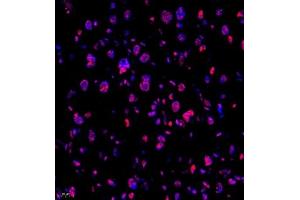 Immunofluorescence of paraffin embedded mouse placenta using Skar (ABIN7074970) at dilution of 1:950 (400x lens) (p46 抗体)