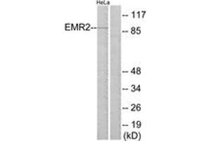 Western blot analysis of extracts from HeLa cells, using EMR2 Antibody. (EMR2 抗体  (AA 121-170))