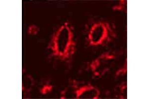 LAMP1 Immunofluorescence.