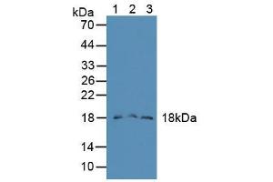 Figure. (FAM19A2 抗体  (AA 31-119))