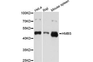 Western blot analysis of extracts of various cell lines, using HMBS antibody (ABIN5970895) at 1/1000 dilution. (HMBS 抗体)
