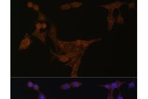 Immunofluorescence analysis of HeLa cells using PPAT Polyclonal Antibody at dilution of 1:100 (40x lens). (PPAT 抗体)