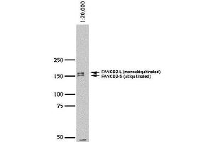Image no. 1 for anti-Fanconi Anemia, Complementation Group D2 (FANCD2) (N-Term) antibody (ABIN363390) (FANCD2 抗体  (N-Term))