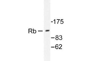 Image no. 2 for anti-Retinoblastoma 1 (RB1) antibody (ABIN271801) (Retinoblastoma 1 抗体)