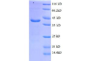 ATP6V1G1 Protein (AA 2-118, full length) (GST tag)