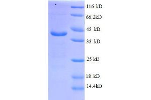 ATPase, H+ Transporting, Lysosomal 13kDa, V1 Subunit G1 (ATP6V1G1) (AA 2-118), (full length) protein (GST tag) (ATP6V1G1 Protein (AA 2-118, full length) (GST tag))