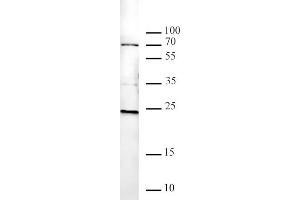Histone H2AK119ub antibody tested by Western blot. (Histone H2A 抗体  (ubLys119))