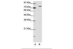 Image no. 1 for anti-MYST Histone Acetyltransferase 2 (MYST2) (N-Term) antibody (ABIN6736157) (MYST2 抗体  (N-Term))