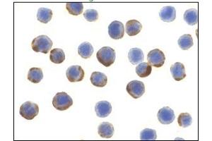 Immunocytochemistry of ATG7 in MCF7 cells with ATG7 Antibody at 10 μg/ml. (ATG7 抗体  (C-Term))