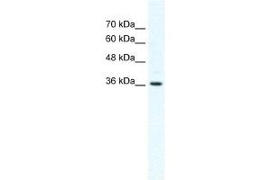 DVL1 antibody used at 2. (DVL1 抗体)