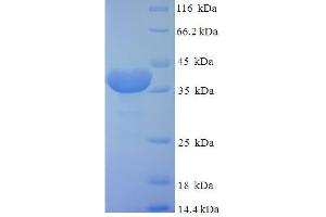 SDS-PAGE (SDS) image for FK506 Binding Protein 14, 22 KDa (FKBP14) (AA 20-211) protein (His-SUMO Tag) (ABIN5711793) (FKBP14 Protein (AA 20-211) (His-SUMO Tag))