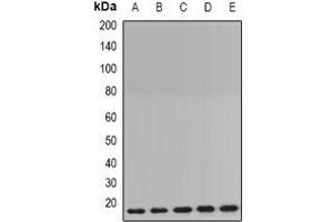 Western blot analysis of Cyclophilin B expression in MCF7 (A), HepG2 (B), mouse brain (C), mouse lung (D), rat liver (E) whole cell lysates. (PPIB 抗体)
