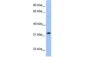 DNALI1 antibody used at 1 ug/ml to detect target protein. (DNALI1 抗体  (C-Term))
