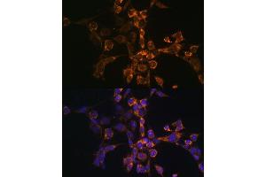 Immunofluorescence analysis of NIH-3T3 cells using Septin 4 Polyclonal Antibody (ABIN6128476, ABIN6147554, ABIN6147555 and ABIN6214410) at dilution of 1:100 (40x lens). (Septin 4 抗体  (AA 1-100))