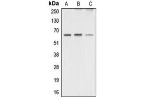 Western blot analysis of AMPK alpha 1/2 expression in HeLa (A), mouse brain (B), rat brain (C) whole cell lysates. (PRKAA1/PRKAA2 抗体  (Center))