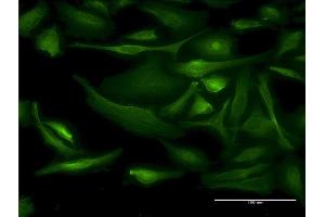 Immunofluorescence of monoclonal antibody to BNIP1 on HeLa cell. (BNIP1 抗体  (AA 1-228))