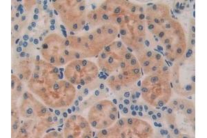 Immunohistochemistry (IHC) image for anti-Bone Morphogenetic Protein 15 (BMP15) (AA 269-391) antibody (ABIN7441844)