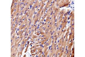 IHC analysis of ACTN2 using anti-ACTN2 antibody (ABIN7602055). (ACTN2 抗体  (AA 567-696))