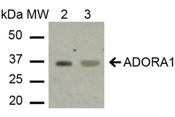 ADORA1 antibody  (C-Term)