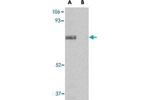 Western blot analysis of SCARB2 in human skeletal muscle tissue lysate with SCARB2 polyclonal antibody  at 1 ug/mL in (A) the absence and (B) presence of blocking peptide. (SCARB2 抗体  (Internal Region))
