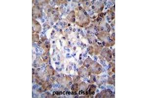TIMP1 Antibody (C-term) immunohistochemistry analysis in formalin fixed and paraffin embedded human pancreas tissue followed by peroxidase conjugation of the secondary antibody and DAB staining. (TIMP1 抗体  (C-Term))