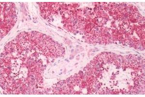 Human Testis: Formalin-Fixed, Paraffin-Embedded (FFPE) (KISS1R 抗体  (Extracellular Domain))