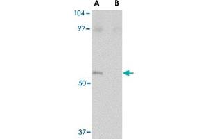 Western blot analysis of LASS5 in SK-N-SH lysate with LASS5 polyclonal antibody  at 1 ug/mL in the (A) absence and (B) presence of blocking peptide. (LASS5 抗体  (C-Term))