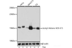 Western blot analysis of extracts of various cell lines using Acetyl-Histone H2B-K15 Polyclonal Antibody at dilution of 1:1000. (Histone H2B 抗体  (acLys15))