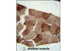 ST3GAL5 antibody immunohistochemistry analysis in formalin fixed and paraffin embedded human skeletal muscle followed by peroxidase conjugation of the secondary antibody and DAB staining. (ST3GAL5 抗体  (C-Term))