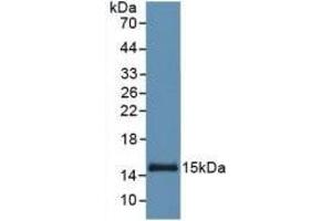 Detection of Recombinant SAA, Human using Monoclonal Antibody to Serum Amyloid A (SAA) (SAA 抗体  (AA 19-122))