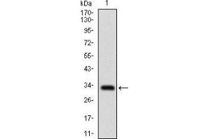 Western blot analysis using SLC27A2 mAb against human SLC27A2 recombinant protein. (SLC27A2 抗体  (AA 346-405))