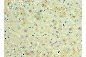 Immunohistochemistry of paraffin-embedded human liver tissue using ABIN7171674 at dilution of 1:100