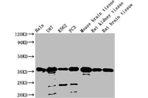 Western blot All lanes: METRNL antibody at 2 μg/mL Lane 1: Mouse small intestine tissue Lane 2: Mouse kidney tissue Lane 3: Rat gonadal tissue Lane 4: Mouse brain tissue Secondary Goat polyclonal to rabbit IgG at 1/10000 dilution Predicted band size: 35, 26 kDa Observed band size: 35 kDa (METRNL 抗体  (AA 46-311))
