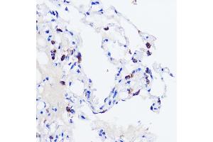 Immunohistochemistry (IHC) image for anti-Surfactant Protein C (SFTPC) (AA 1-197) antibody (ABIN3015598)