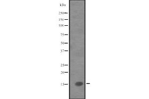 Western blot analysis of IL9 expression in Human fetal liver lysate,The lane on the left is treated with the antigen-specific peptide. (IL-9 抗体  (Internal Region))
