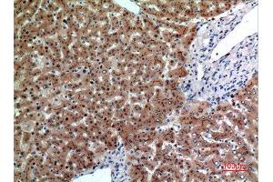 Immunohistochemistry (IHC) analysis of paraffin-embedded Human Liver, antibody was diluted at 1:100. (CEACAM5 抗体  (Internal Region))