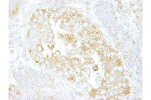 Immunohistochemistry (IHC) image for anti-rho GTPase Activating Protein 1 (ARHGAP1) (AA 1-50) antibody (ABIN7448467) (ARHGAP1 抗体  (AA 1-50))