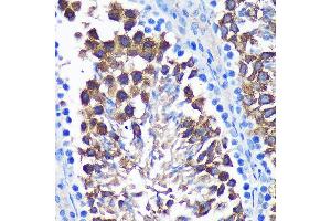 Immunohistochemistry (IHC) image for anti-SUMO1/sentrin Specific Peptidase 1 (SENP1) (AA 220-420) antibody (ABIN6147534)