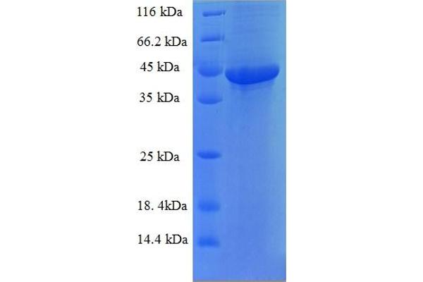 FAM109B Protein (AA 1-259, full length) (His-SUMO Tag)