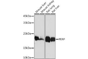 Western blot analysis of extracts of various cell lines, using PERP Rabbit mAb (ABIN7270861) at 1:1000 dilution. (PERP 抗体)