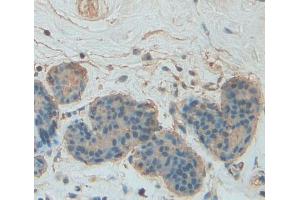Used in DAB staining on fromalin fixed paraffin- embedded breast tissue (PLIN4 抗体  (AA 349-656))
