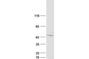 Western Blotting (WB) image for Ankyrin Repeat and SOCS Box Containing 6 (ASB6) (Transcript Variant 1) protein (Myc-DYKDDDDK Tag) (ABIN2714969)