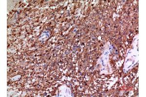 Immunohistochemistry (IHC) analysis of paraffin-embedded Human Brain, antibody was diluted at 1:100. (alpha Tubulin 抗体)