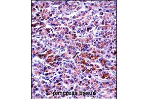 PRSS2 Antibody (Center) ((ABIN657641 and ABIN2846637))immunohistochemistry analysis in formalin fixed and paraffin embedded human pancreas tissue followed by peroxidase conjugation of the secondary antibody and DAB staining. (PRSS2 抗体  (AA 80-108))